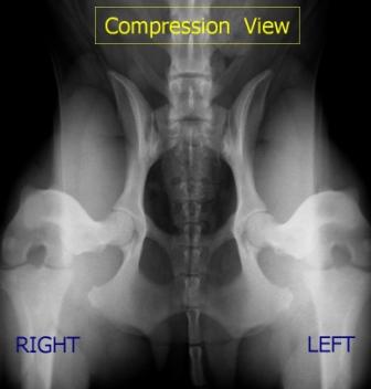 Vue en compression